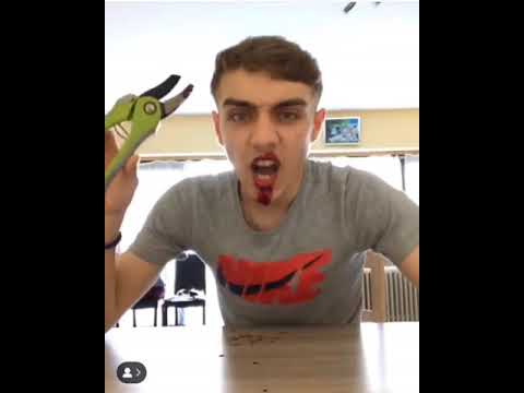 « PRANK: JAMAL FAIT CROIRE A SA MÈRE QU’IL C’EST COUPER LA LÈVRE »🤦‍♂️